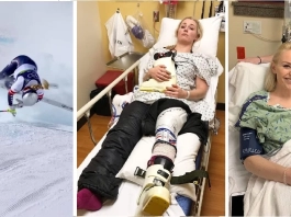 Кадри от: падането на Линдзи Вон на олимпиадата в Италия 2026 и моменти преди и след операцията