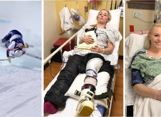 Кадри от: падането на Линдзи Вон на олимпиадата в Италия 2026 и моменти преди и след операцията