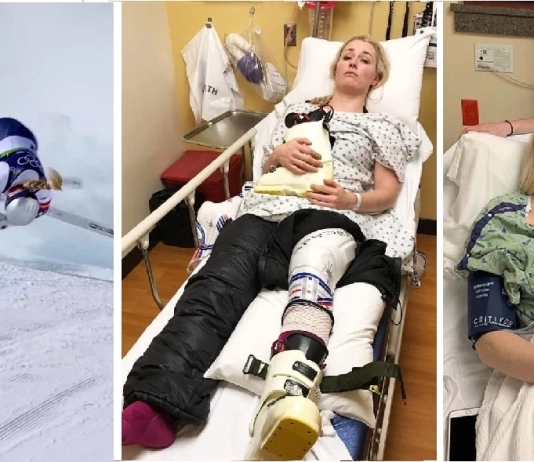 Кадри от: падането на Линдзи Вон на олимпиадата в Италия 2026 и моменти преди и след операцията